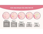 Các giai đoạn của ung thư vú